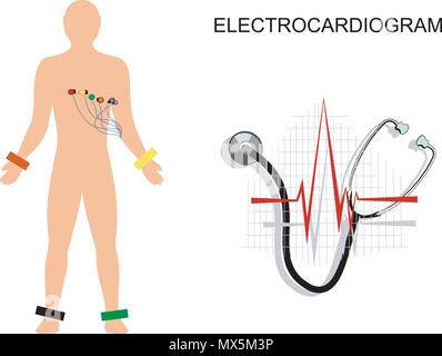 Illustrazione dell'elettrocardiogramma. Il paziente con gli elettrodi sul torace. Illustrazione Vettoriale