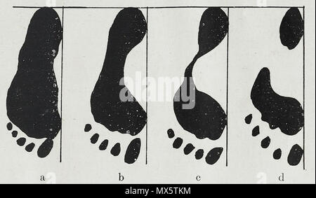 . Inglese: un illustrazione anatomica dal 1921 edizione tedesca di anatomie des Menschen: Ein Lehrbuch für Studierende und Ärzte con la terminologia latina. Il 30 novembre 2013, 13:14:46. Braus, Hermann 97 Braus 1921 303 Foto Stock