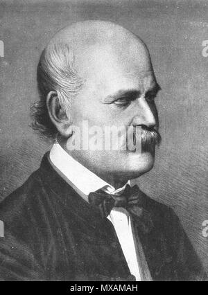 . Ignaz Semmelweis 1860 (piastra di rame incisione di Jenő Doby) . 1860. Jenő Doby 292 Ignaz Semmelweis 1860 Foto Stock