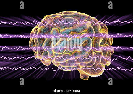 Cervello e attiva le onde cerebrali, illustrazione del computer. Un'elettroencefalogramma (EEG) misura l'attività elettrica del cervello utilizzando elettrodi collegati al cuoio capelluto. Vari disturbi possono essere diagnosticati analizzando i risultati EEG. Foto Stock