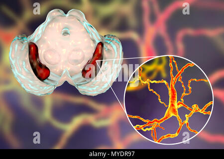 Substantia nigra. Computer illustrazione che mostra un sano substantia nigra del cervello di un uomo e di una vista ravvicinata di neuroni dopaminergici trovati nella substantia nigra. La substantia nigra svolge un ruolo importante nella ricompensa, tossicodipendenza, e movimento. La degenerazione di questa struttura è una caratteristica del morbo di Parkinson. Foto Stock