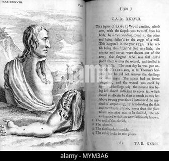 . William Cheselden (1688-1752): l'anatomia del corpo umano. Londra: W. Bowyer, 1741. Gennaio 2008. McLeod 108 Cheselden Samuel braccio di legno Foto Stock
