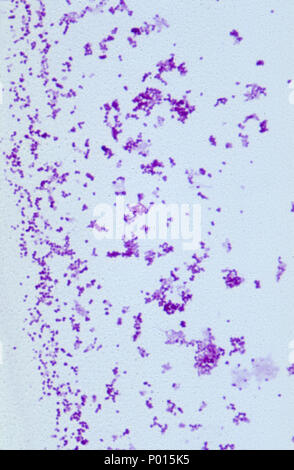 Neisseiria gonorrhoeae batteri Foto Stock