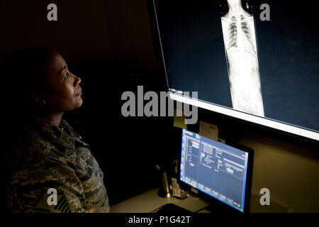 Master Sgt. Tracey McLendon, 23d supporto medico di volo squadrone chief di imaging diagnostico, legge un X-ray, Ott. 24, 2016 a Moody Air Force Base, Ga. Un semplice osso rotto potrebbe diventare potenzialmente letale se frammenti ossei danneggiare organi. Quando la sezione di radiologia recensioni i loro raggi X, sono alla ricerca di eventuali anomalie. (U.S. Air Force foto di Airman 1. Classe Daniel Snider) Foto Stock