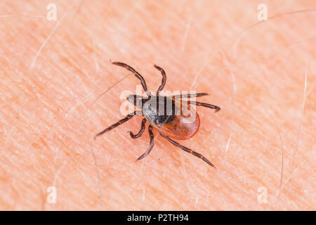 Una femmina di tick, Ixodes ricinus, strisciando su di un braccio umano. È stato trovato in una zona dove i cervi e altri mammiferi sono presenti. Questo tick è nota anche come Foto Stock