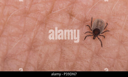 Piccoli cervi la spunta su pelle umana di close-up. Ixodes ricinus. Pericoloso parassita pungente. Esso trasporta encefalite, borelliosi di Lyme, babesiosi, ehrlichiosis. Foto Stock