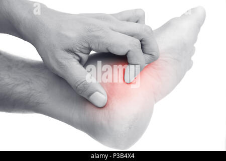Prurito piede isolato su sfondo bianco. Foto Stock