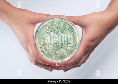 Mani femminili tenendo una piastra Petri con colonie batteriche su agar-agar. Colore bianco-blu selezione di E.coli per rilevare le inserzioni del costrutto vettore in un Foto Stock