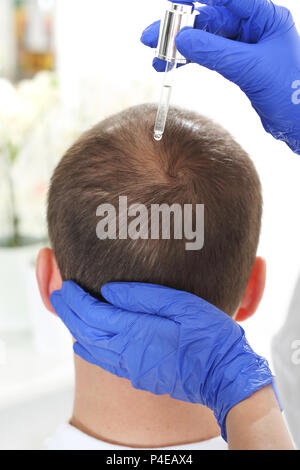 Ampolla per la crescita dei capelli. Il parrucchiere mette la preparazione sui capelli dell'uomo. Fiala per capelli. Nutrizione del cuoio capelluto applicando i preperati cosmetici. Foto Stock