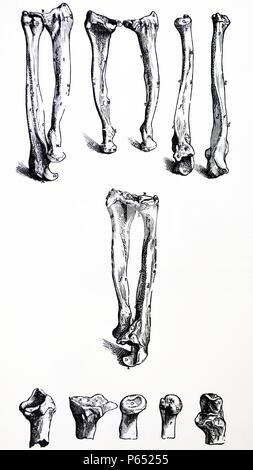 Le piastre del primo libro del De humani corporis fabrica di Andreas Vesalius, (1514-1564) piastra 15 - Nella seconda figura del ventiquattresimo Capitolo entrambe le ossa dell'avambraccio sinistro che è la radio e ulna sono rappresentati dall'esterno (posteriore) superficie. Foto Stock