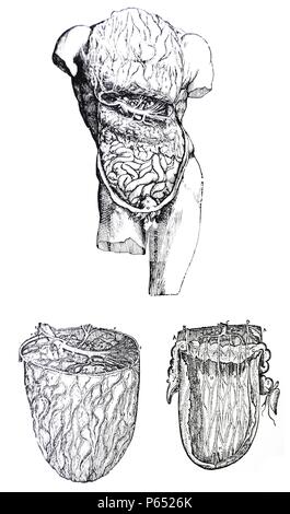 Le piastre dal quinto libro del De humani corporis fabrica di Andreas Vesalius, (1514-1564) piastra 54 - La terza figura segue il secondo in ordine di somministrazione e mostra la membrana inferiore dell'omento strappato e tirato libera dalla parte superiore degli strati anteriore. Foto Stock
