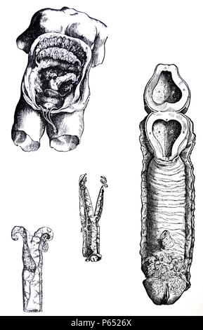 Le piastre dal quinto libro del De humani corporis fabrica di Andreas Vesalius, (1514-1564) piastra 60 - In questa figura il tronco del corpo femminile è rappresentato giacente a terra. Il peritoneo, insieme con i muscoli addominali è stato aperto ed è stata tirata verso i lati. Foto Stock