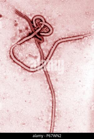 Microscopio elettronico a trasmissione del virus Ebola febbre emorragica del virus di RNA Foto Stock