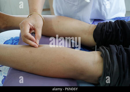 Tradizionale vietnamita medicina clinica. L'agopuntura. Cu Chi. Il Vietnam. Foto Stock