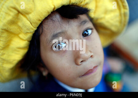 Free health clinic gestito dalle Suore Francescane Missionarie di Maria. La minoranza etnica bambino. Dalat. Il Vietnam. Foto Stock