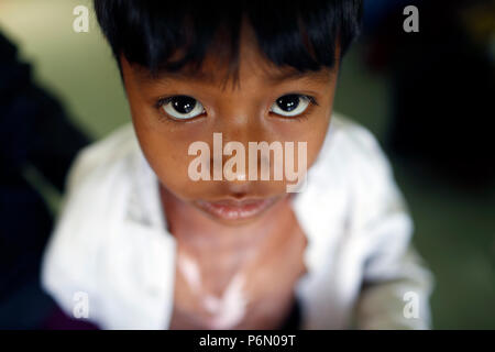 Free health clinic gestito dalle Suore Francescane Missionarie di Maria. La minoranza etnica bambino. Dalat. Il Vietnam. Foto Stock