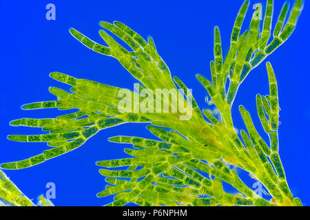 Vista microscopico di alghe verdi (Cladophora). Rheinberg illuminazione. Foto Stock