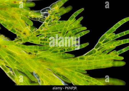 Vista microscopico di alghe verdi (Cladophora). Visibile anche cellule di diatomee. Illuminazione a campo oscuro. Foto Stock