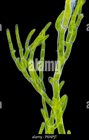 Vista microscopico di alghe verdi (Cladophora) ramo. Illuminazione a campo oscuro. Foto Stock