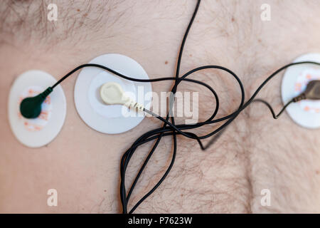 Monitor Holter dispositivo sul maschio umano corpo. Daily cardiogram esame. Il grasso in eccesso persona. Elevato rischio di malattia cardial. La cura della salute e la prevenzione delle malattie Foto Stock