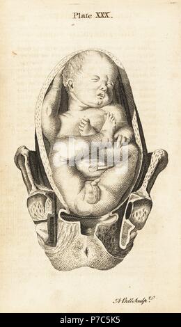 Vista frontale di un feto nel parto podalico posizione nell'utero. Incisione su rame di Andrew Bell dopo una illustrazione di Jan van Rymsdyk da William Smellie una serie di tavole anatomiche, Charles Elliot, Edimburgo, 1780. Foto Stock