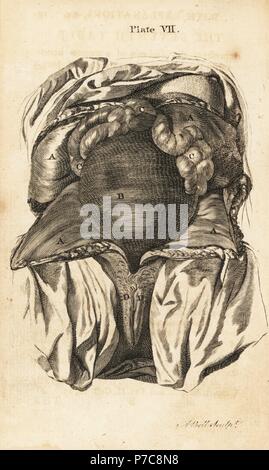 Il ventre di una donna nel sesto o settimo mese di gravidanza, mostrando Utero Intestino, labia pudendi. Incisione su rame di Andrew Bell dopo una illustrazione di Jan van Rymsdyk da William Smellie una serie di tavole anatomiche, Charles Elliot, Edimburgo, 1780. Foto Stock