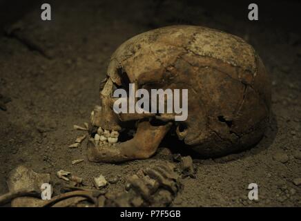 Era vichinga. Birka ragazza. Morì all età di 6 anni. Decimo secolo. Scheletro. Il cranio. Museo storico. Stoccolma. La Svezia. Foto Stock