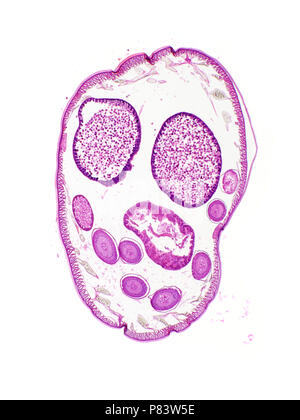 Gli Ascaris, la sezione, la micrografia di luce, area raffigurato è di circa 6mm di altezza Foto Stock