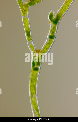 Vista microscopico di alghe verdi (Cladophora) ramo a forcella. Obliqua di Rheinberg illuminazione. Foto Stock