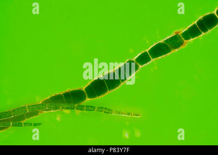 Vista microscopico di alghe verdi (Cladophora) filamenti. Rheinberg illuminazione. Foto Stock