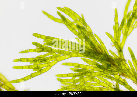 Vista microscopico di alghe verdi (Cladophora). Illuminazione a campo chiaro. Foto Stock