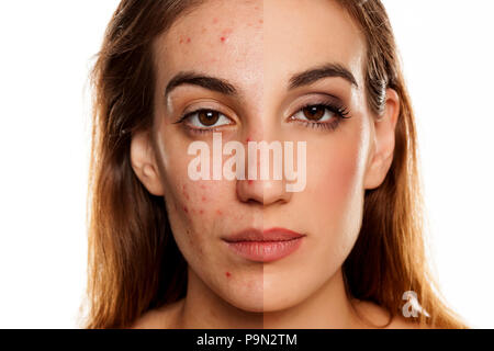 Comparition ritratto della stessa donna prima e dopo il trattamento cosmetico amd trucco su sfondo bianco Foto Stock