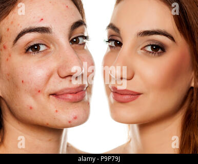 Ritratto di confronto della stessa donna prima e dopo il trattamento cosmetico e il trucco su sfondo bianco Foto Stock