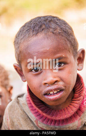 MADAGASCAR - Giugno 30, 2011: Ritratto di un ragazzo non identificato iwatching la fotocamera in Madagascar, il 30 giugno 2011. I bambini del Madagascar soffrono di povert Foto Stock