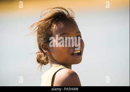 MADAGASCAR - luglio 5, 2011: Ritratto di un non ben identificato bella ragazza in Madagascar, 5 luglio 2011. I bambini del Madagascar soffrono di povertà a causa della Foto Stock