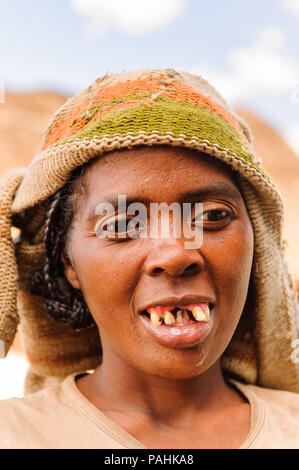 MADAGASCAR - Giugno 30, 2011: Ritratto di un non ben identificato teethless donna Madagascar, 30 giugno 2011. La popolazione del Madagascar soffrono di povertà a causa della u Foto Stock