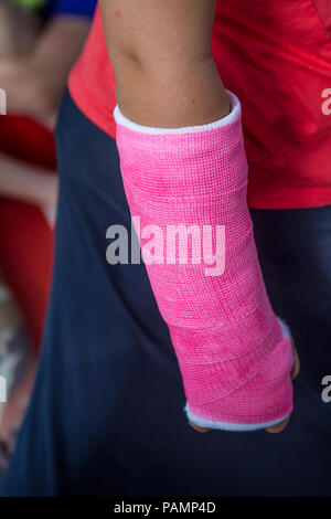 Foto della ragazza e il braccio destro è in rosa cast. Modello di Rilascio #114 Foto Stock