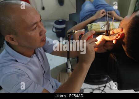 Il vietnamita barbiere. Pulizia dell'orecchio. Ho Chi Minh City. Il Vietnam. | Utilizzo di tutto il mondo Foto Stock