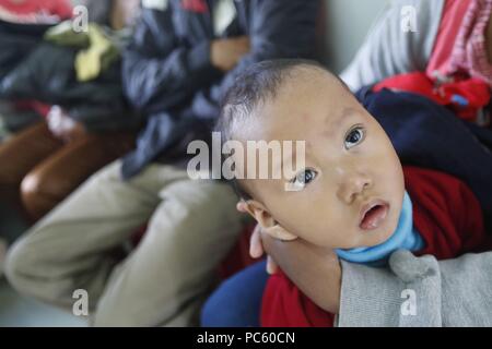 Free health clinic gestito dalle Suore Francescane Missionarie di Maria. La minoranza etnica bambino. Dalat. Il Vietnam. | Utilizzo di tutto il mondo Foto Stock
