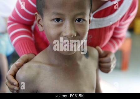 Free health clinic gestito dalle Suore Francescane Missionarie di Maria. La minoranza etnica bambino. Dalat. Il Vietnam. | Utilizzo di tutto il mondo Foto Stock