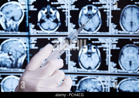 La risonanza magnetica la scansione del cervello. MRI. Siringa in mano. Foto Stock