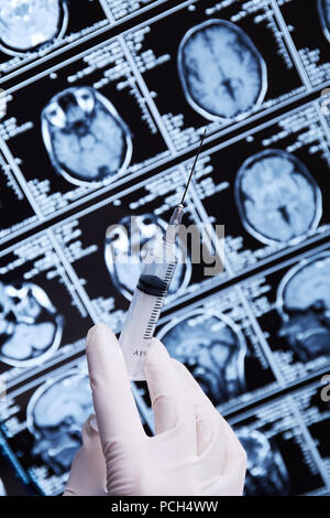 La risonanza magnetica la scansione del cervello. MRI. Siringa in mano. Foto Stock