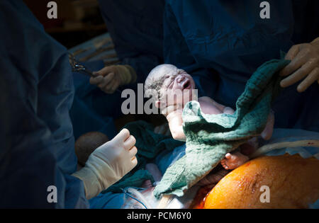 Una donna di parto gemellare mediante taglio cesareo (Heverlee, 30/12/2016) Foto Stock