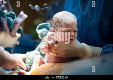 Una donna di parto gemellare mediante taglio cesareo (Heverlee, 30/12/2016) Foto Stock