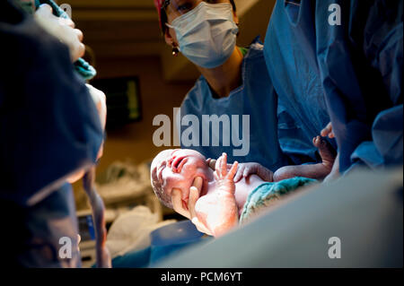 Una donna di parto gemellare mediante taglio cesareo (Heverlee, 30/12/2016) Foto Stock