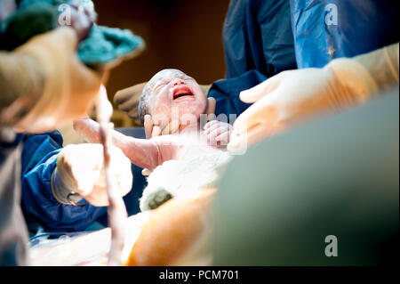 Una donna di parto gemellare mediante taglio cesareo (Heverlee, 30/12/2016) Foto Stock