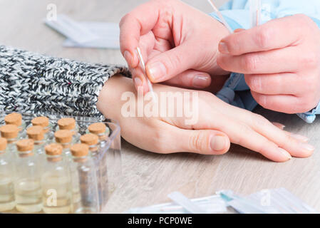 Terapista di agopuntura applicando aghi di agopuntura per il suo cliente la mano Foto Stock