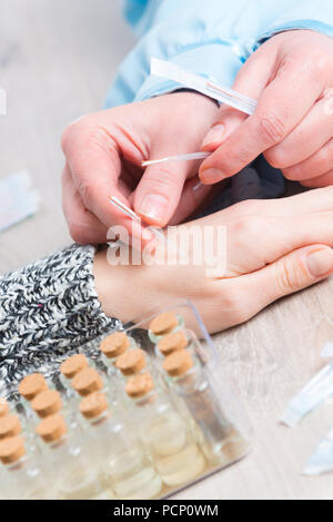 Terapista di agopuntura applicando aghi di agopuntura per il suo cliente la mano Foto Stock