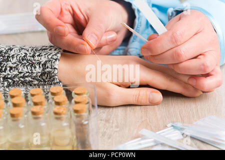 Terapista di agopuntura applicando aghi di agopuntura per il suo cliente la mano Foto Stock