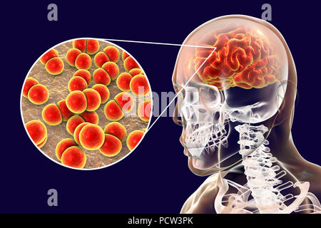 La Neisseria meningitidis infezione cerebrale, illustrazione del computer. N. meningitidis sono gram-negativi diplococci (batteri sferiche disposte in coppie), trasmessi tramite la via respiratoria. Nella maggior parte delle persone provocano infezioni asintomatiche o non gravi nasopharingitis, ma può anche causare gravi meningite e infezione generalizzata (meningococcaemia), in particolare per i bambini. La loro superficie è ricoperta con pilli che prendere parte in attacco di batteri per cellule e superfici. Foto Stock